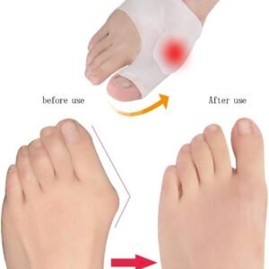 Big Toe Overlap Correction, Hallux Valgus Splitter, Insoles Silica Gel Pad Protectors, Toe Caps Blister Protectors, Metatarsal for Forefoot Cushion, Unisex